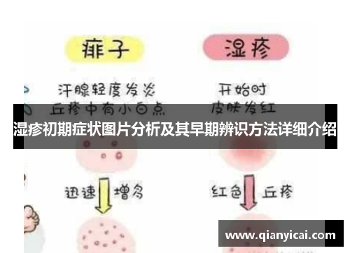 湿疹初期症状图片分析及其早期辨识方法详细介绍